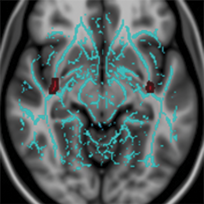 UF, an important tract connecting the two extrahypothalamic regions